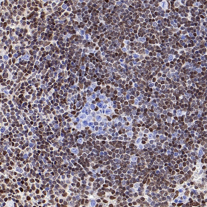 p27 Kip1 Recombinant Rabbit mAb (SDT-361-324)