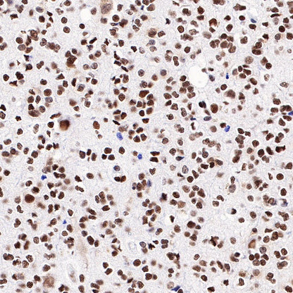 CREB Recombinant Rabbit mAb (S-747-60)