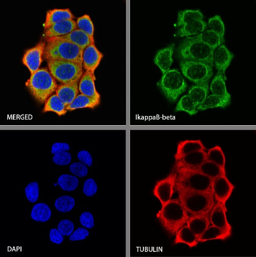 IκBβ Recombinant Rabbit mAb (S-810-203)