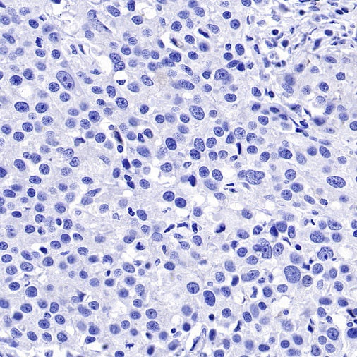 MelanA Recombinant Rabbit mAb (SDT-3352)