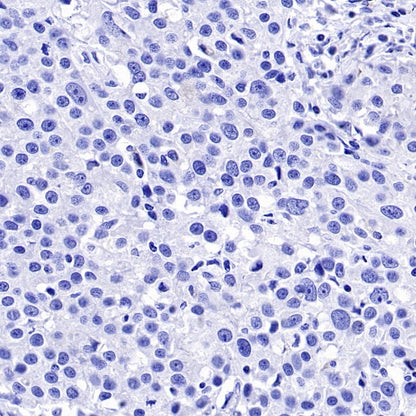 MelanA Recombinant Rabbit mAb (SDT-3352)