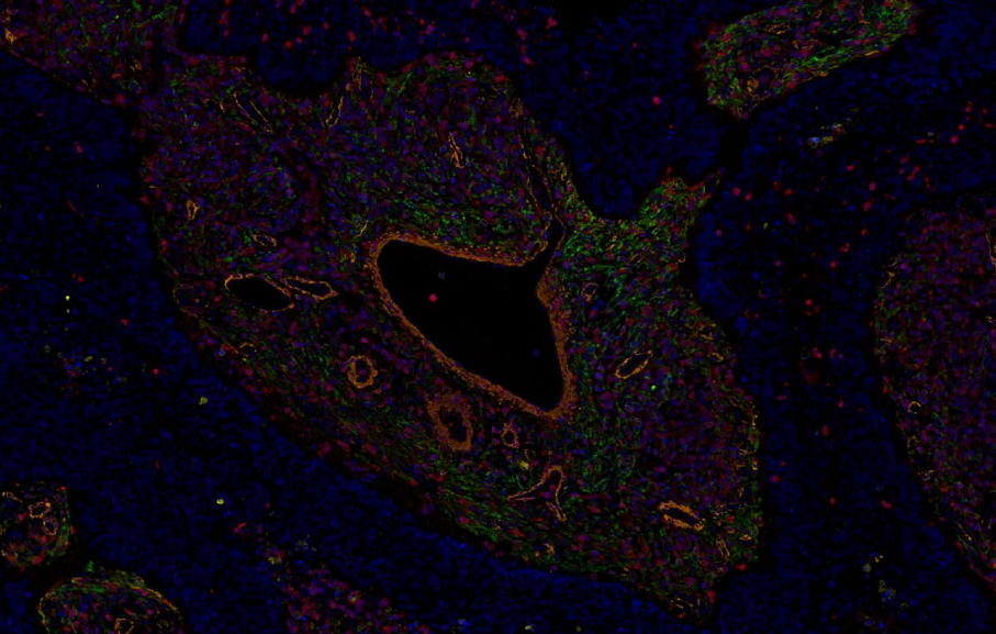 Absin 5-Color IHC Kit (Anti-Rabbit Secondary Antibody)