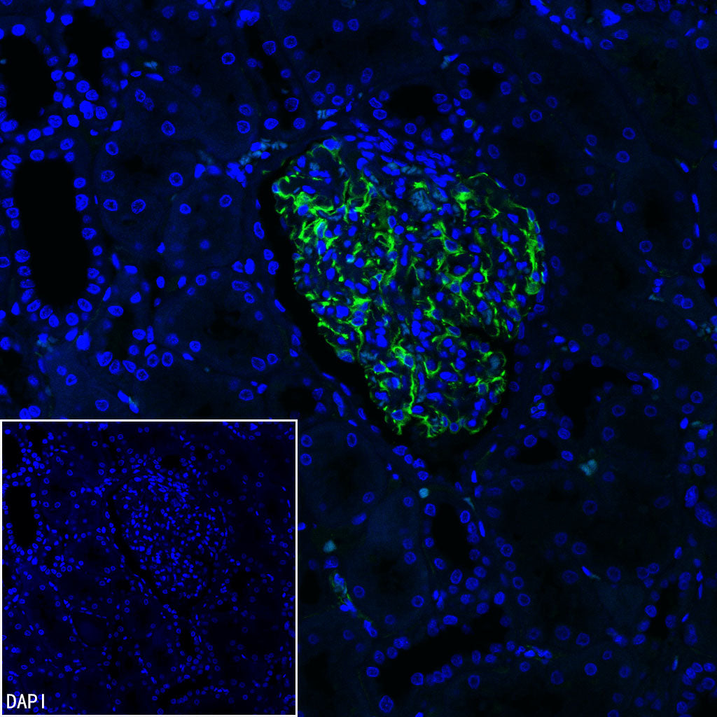 Nestin Recombinant Rabbit mAb (S-3890-112)