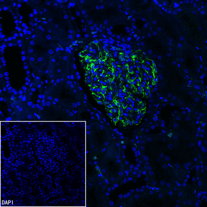 Nestin Recombinant Rabbit mAb (S-3890-112)