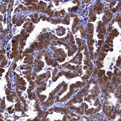 Neuropilin 1 Recombinant Rabbit mAb (S-1453-6)