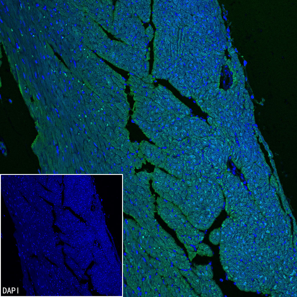 Myoglobin Recombinant Rabbit mAb (S-6197)
