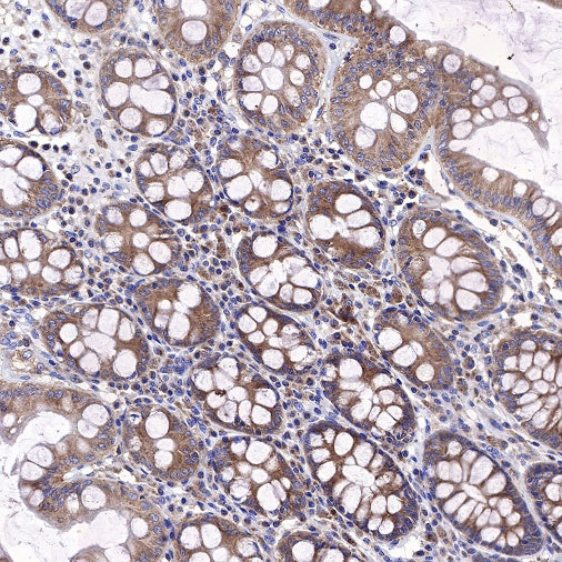 KRAS Recombinant Rabbit mAb (S-443-69)