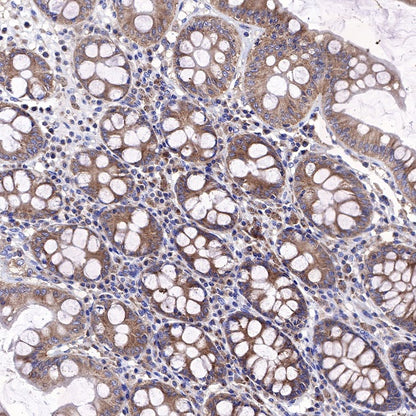 KRAS Recombinant Rabbit mAb (S-443-69)