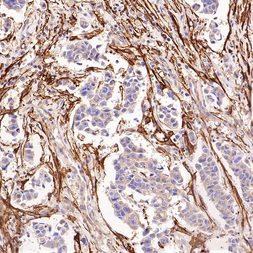 LRRC15 Recombinant Rabbit mAb (S-2473-43)