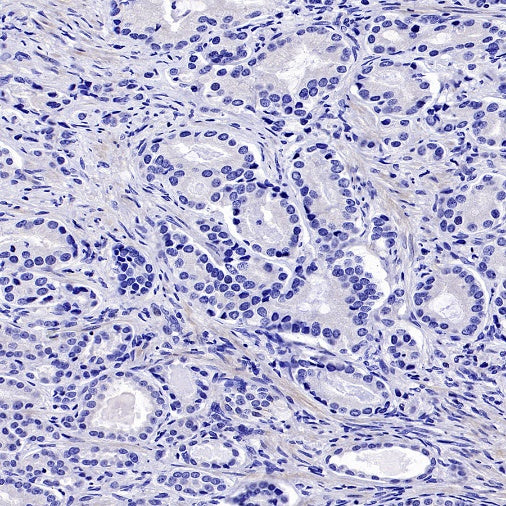 LIN28A Rabbit Polyclonal Antibody