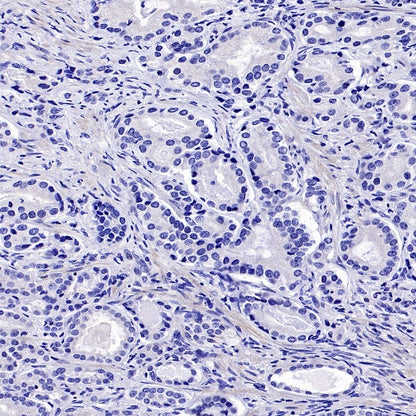 LIN28A Rabbit Polyclonal Antibody