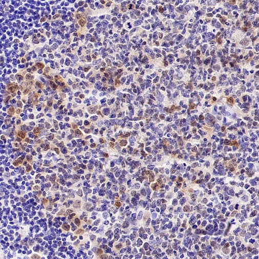 CDK6 Recombinant Rabbit mAb (S-1312-23)