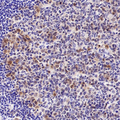 CDK6 Recombinant Rabbit mAb (S-1312-23)