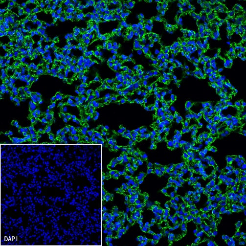 CD31 Recombinant Rabbit mAb (S-R568)