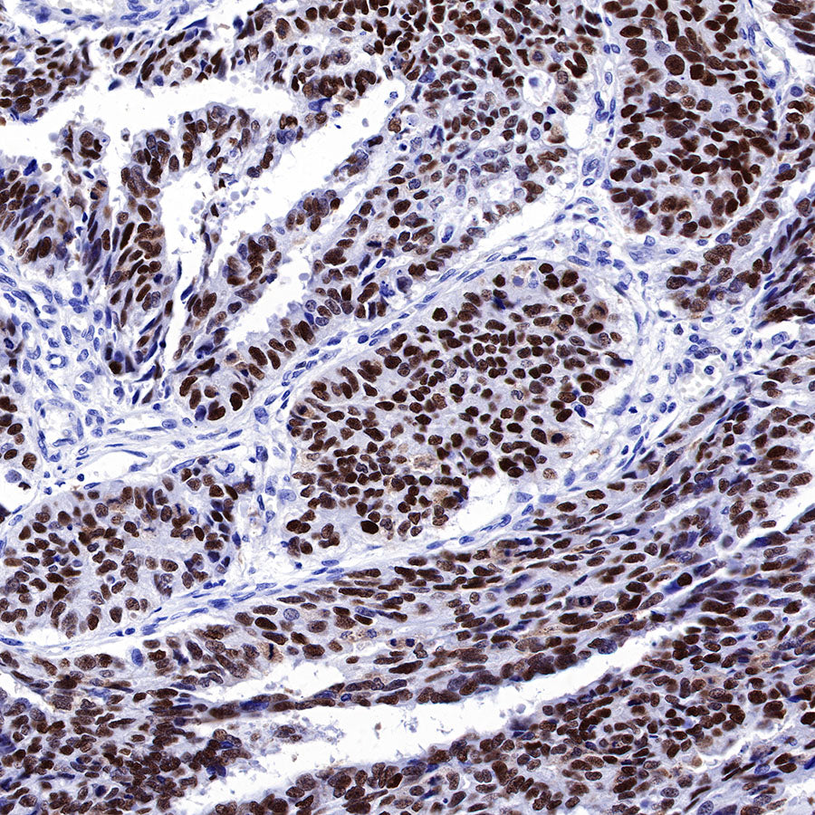 S-RMab® p53 Recombinant Rabbit mAb (SDT-R118)