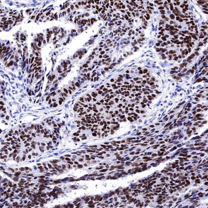 S-RMab® p53 Recombinant Rabbit mAb (SDT-R118)