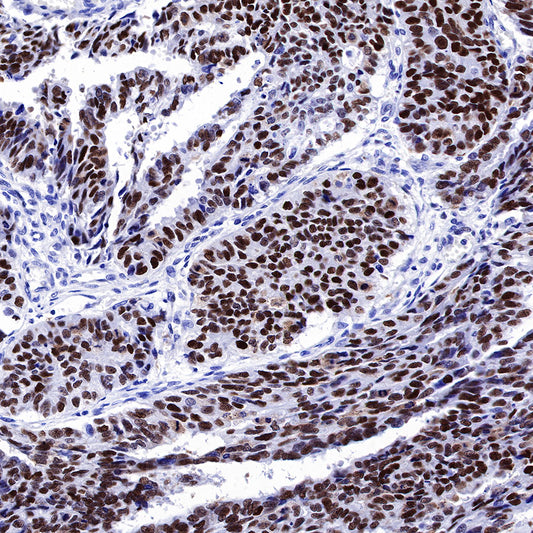 S-RMab® p53 Recombinant Rabbit mAb (SDT-R118)