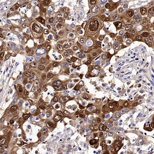 SERPINB3 Recombinant Rabbit mAb (S-4587)