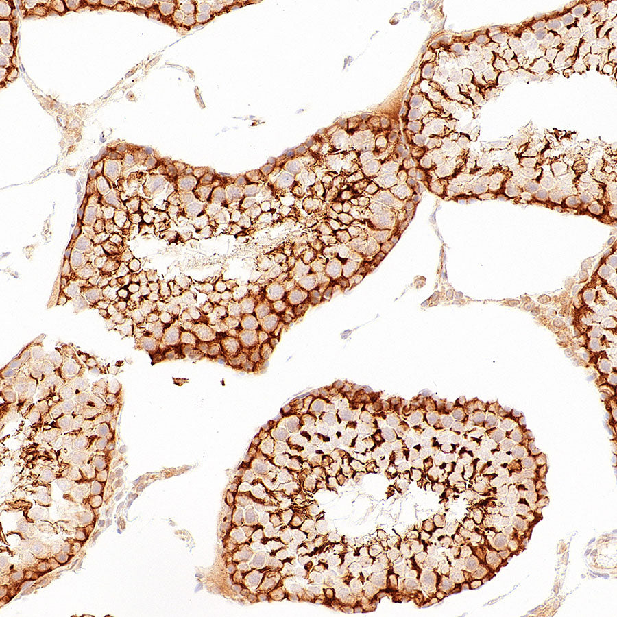 p58IPK/DNAJC3 Recombinant Rabbit mAb (S-4816-205)