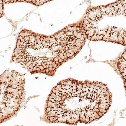 p58IPK/DNAJC3 Recombinant Rabbit mAb (S-4816-205)