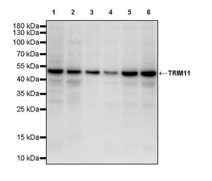 TRIM11 Recombinant Rabbit mAb (S-2913-79)