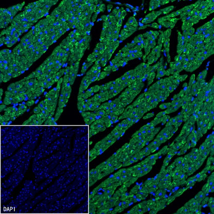 TRIM63 Recombinant Rabbit mAb (S-2304-110)