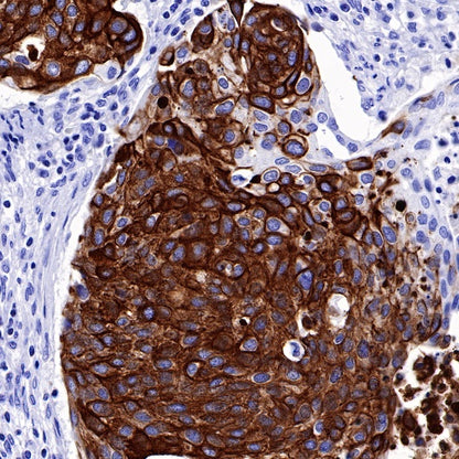 CK-13 Recombinant Rabbit mAb (SDT-641-41)