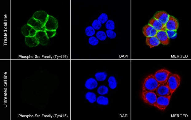Phospho-Src Family (Tyr416) Recombinant Rabbit mAb (S-1556-29)