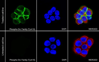 Phospho-Src Family (Tyr416) Recombinant Rabbit mAb (S-1556-29)