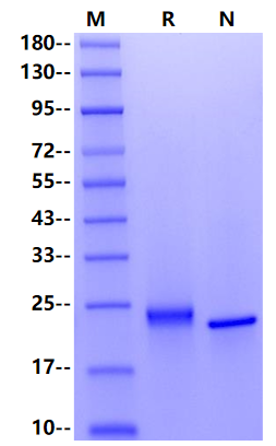 TIMP-2 Protein, Human