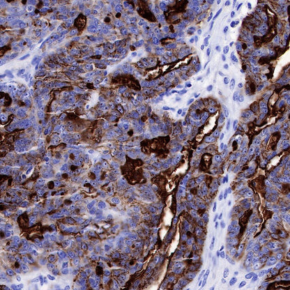 CA125 Recombinant Rabbit mAb (SDT-555-41)