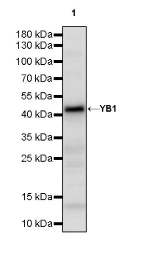 YB1 Recombinant Rabbit mAb (S-1748-144)