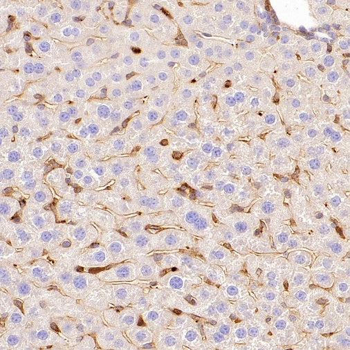 Talin-1 Recombinant Rabbit mAb (S-1483-25)