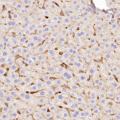 Talin-1 Recombinant Rabbit mAb (S-1483-25)