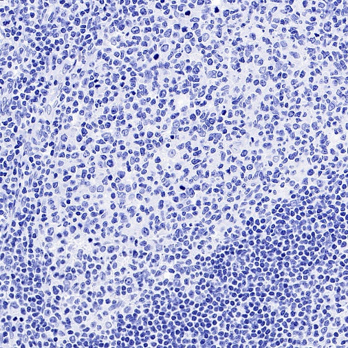 Human Growth Hormone / GH Recombinant Rabbit mAb (SDT-1160-40)