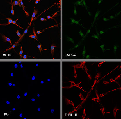 SMARCA3 Recombinant Rabbit mAb (S-3575-154)