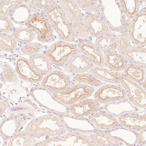 RB1CC1 Recombinant Rabbit mAb (S-2367-251)
