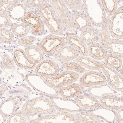 RB1CC1 Recombinant Rabbit mAb (S-2367-251)