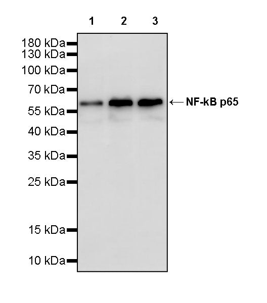 NF-kB p65 Recombinant Rabbit mAb (S-5142)