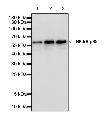 NF-kB p65 Recombinant Rabbit mAb (S-5142)