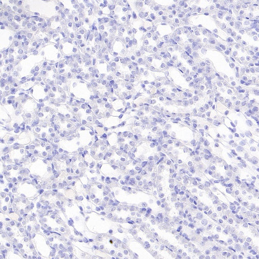 MAP2 Recombinant Rabbit mAb (S-3110-72)