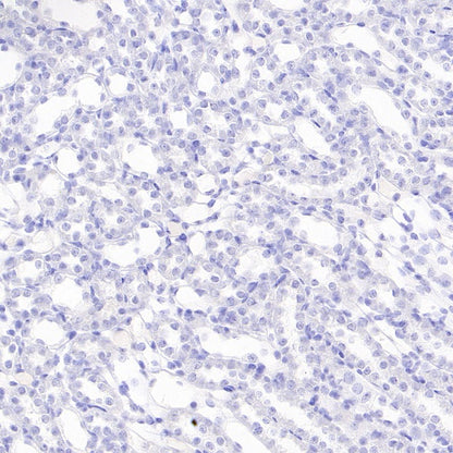 MAP2 Recombinant Rabbit mAb (S-3110-72)