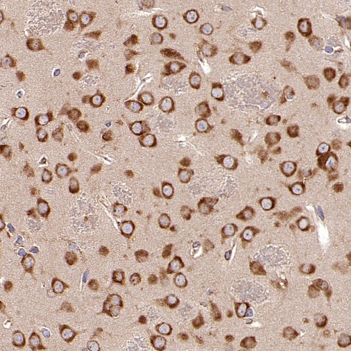 NMT1 Recombinant Rabbit mAb (S-2986-17)