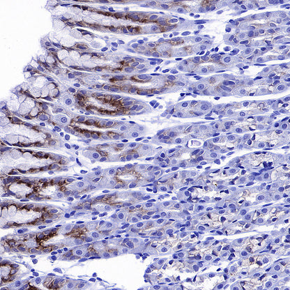 COX2 / Cyclooxygenase Recombinant Rabbit mAb (S-5952)