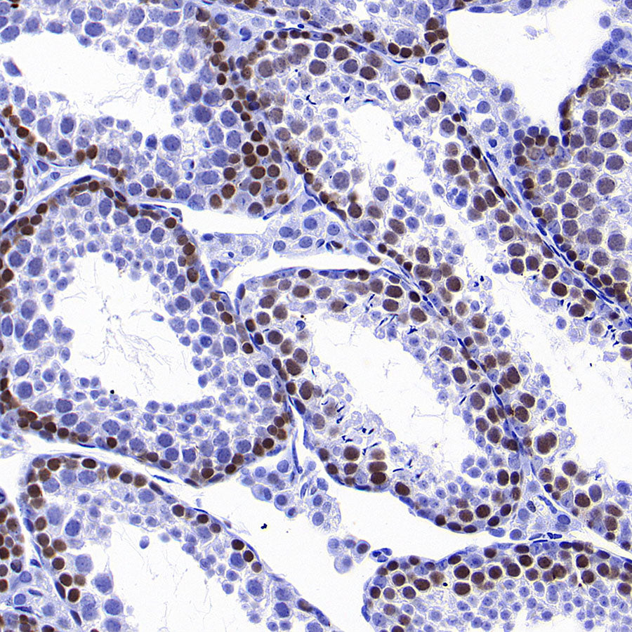 PCNA Recombinant Rabbit mAb (S-5313)