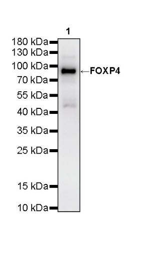 FOXP4 Recombinant Rabbit mAb (S-6198)