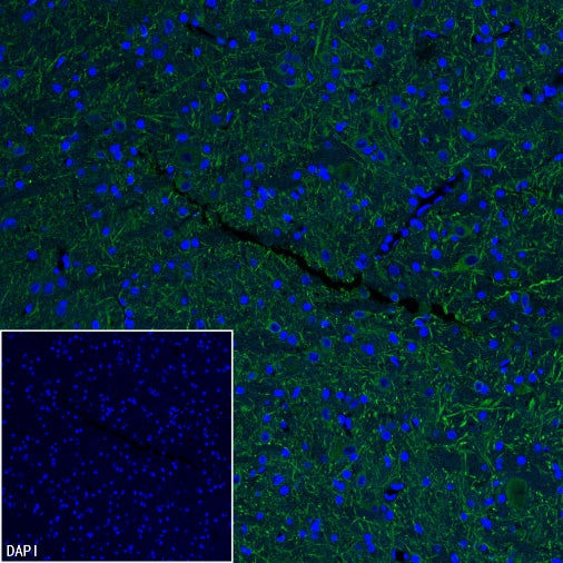 MAP2 Recombinant Rabbit mAb (S-3110-72)