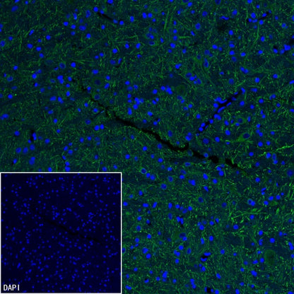 MAP2 Recombinant Rabbit mAb (S-3110-72)