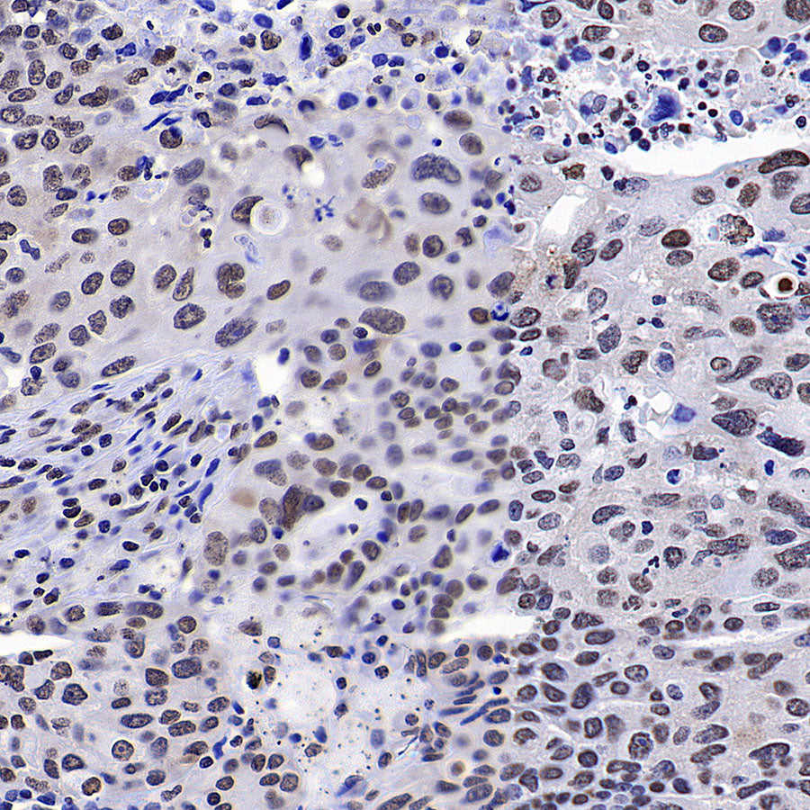 HNRNPA2B1 Mouse mAb