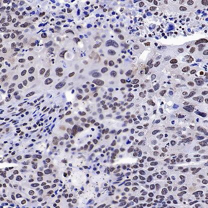 HNRNPA2B1 Mouse mAb
